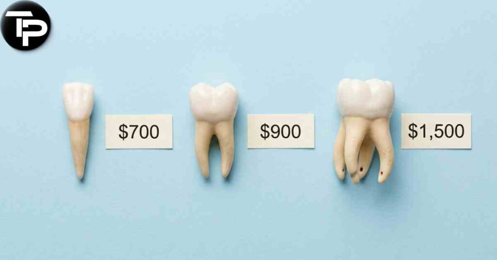 How Much Is a Root Canal